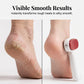 🔥Last day of the limited-time 50% off sale🔥 Double-Sided Foot Scraper for Callus – Stainless Steel, Dual Surface, Portable 🏃‍♀️