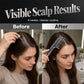 🎉BUY 2 GET 1 FREE🎁 Scalp Applicator Comb Tool for Hair