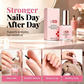📢📢 50% OFF💅Nail Strengthener – Helps Strengthen Soft, Weak Nails & Improve Nail Appearance